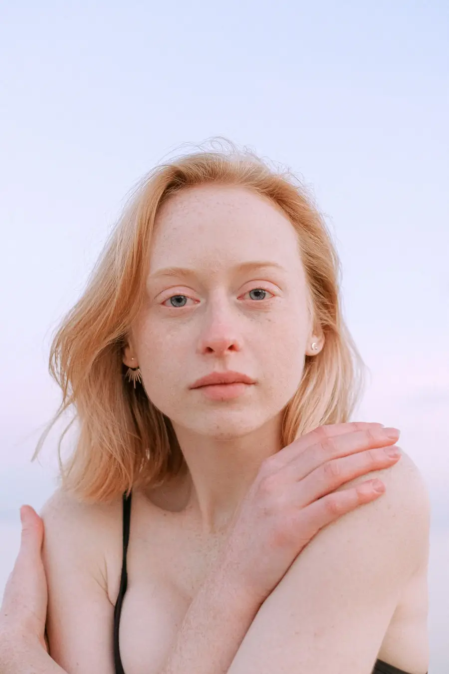 Dry skin