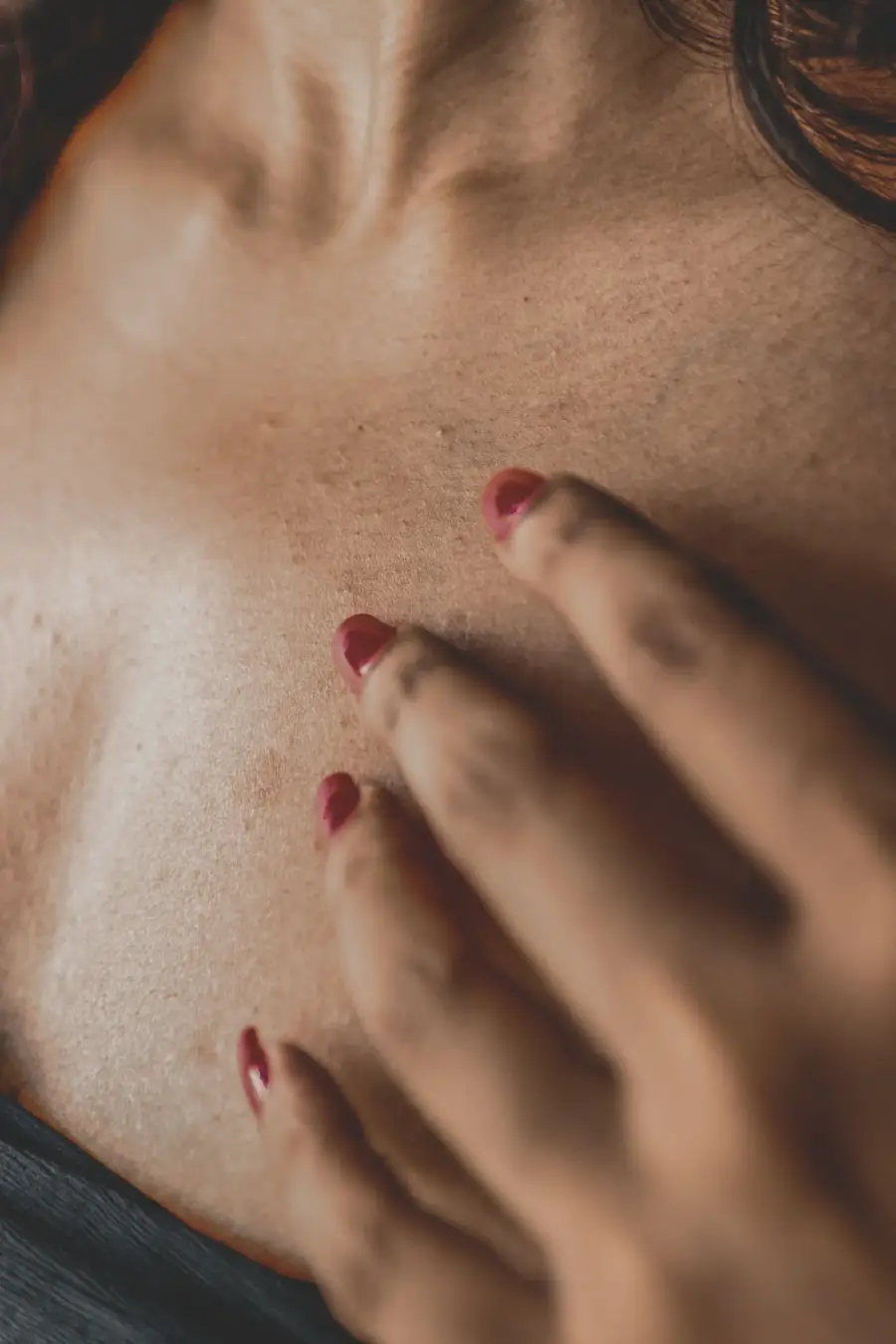 Atopic dermatitis