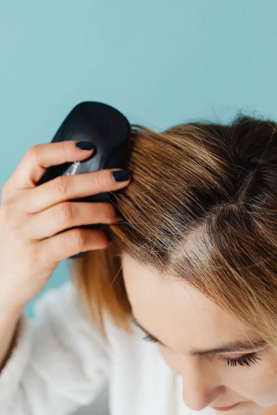 Female pattern hair loss