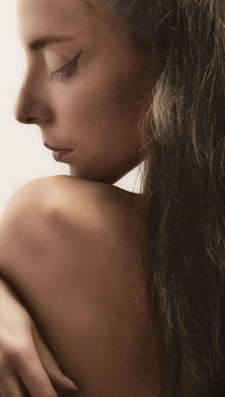 Melasma